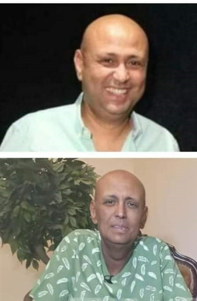 الفنان جمال يوسف قبل وبعد الجلسات الكيماوية لعلاج سرطان البلعوم 