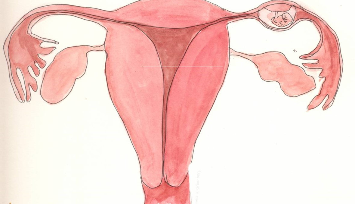 أسباب الحمل خارج الرحم