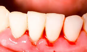 أمراض تقترن بالم الاسنان
