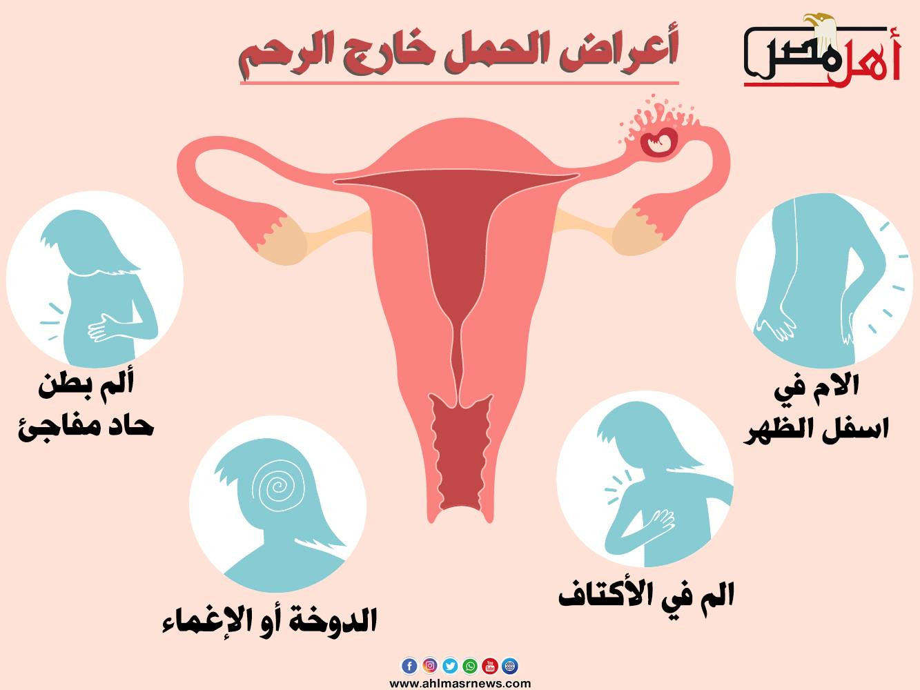 علامات الحمل خارج الرحم