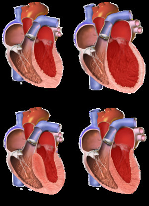 كيفية تشخيص اعتلال عضلة القلب