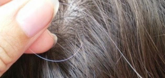 أسباب ظهور الشعر الأبيض في سن مبكرة