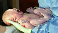 أضرار الولادة القيصرية