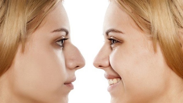 في هذه الحالات يرفض الطبيب إجراء عمليات تجميل الأنف