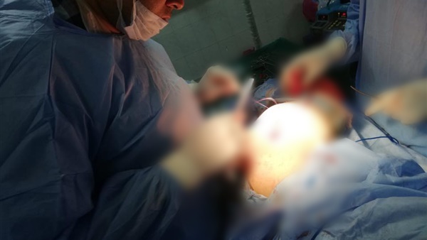 جراحة حرجة لمريضة من ضمن قوائم الانتظار بالدقهلية (صور)
