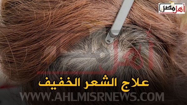 علاج الشعر الخفيف