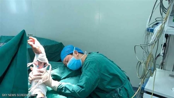 طبيب ينام داخل غرفة العمليات بعد إجرائه لـ6 عمليات دون انقطاع