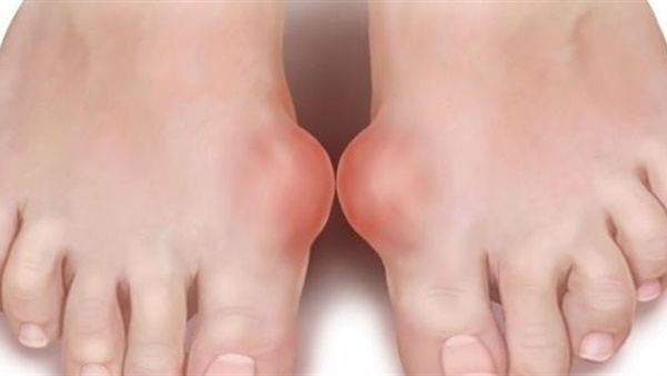 جلود الأضاحي