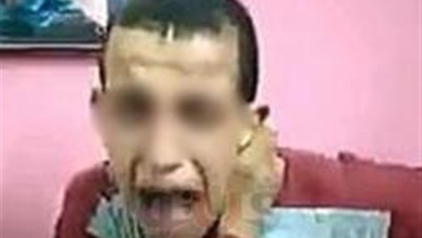 خبير قانوني يوضح عقوبة المتهمين بالاعتداء على شاب من ذوي الاحتياجات الخاصة بالشرقية
