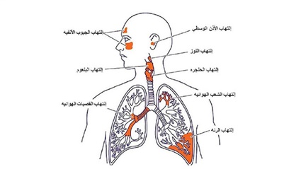 احذر انتشار فيروس