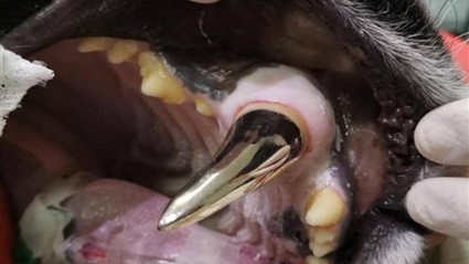  إجراء عملية زرع