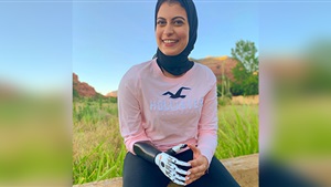 بطرف صناعي وفستان