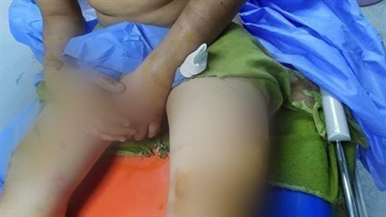 ماء مغلي وضرب بآلة